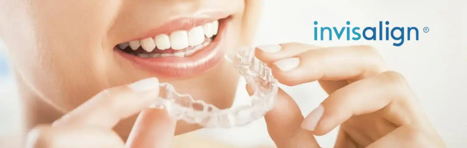 invisalign barcelona precio