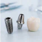 Componentes de un implante dental Instituto Volpe.webp