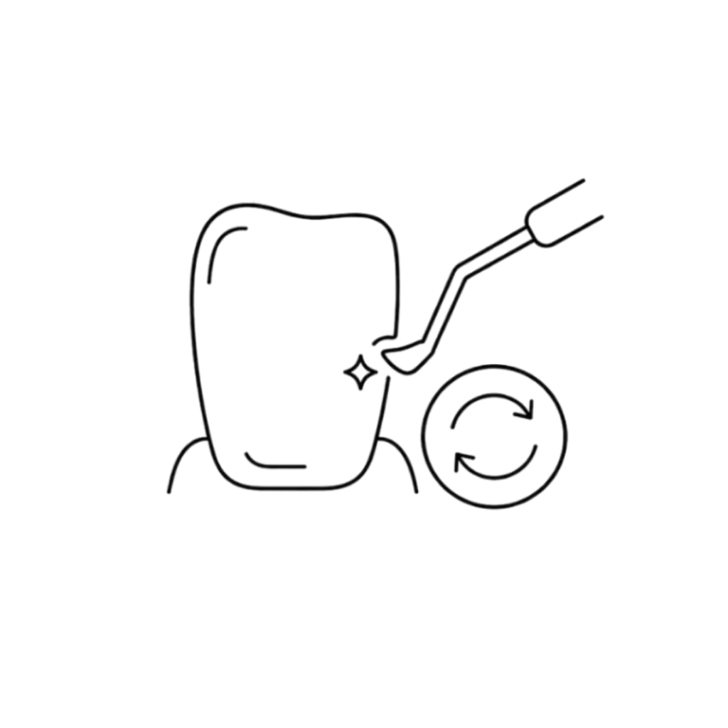 carillas de composite con modelado directo en el diente