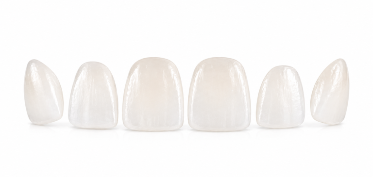 carillas de porcelana sin tallado