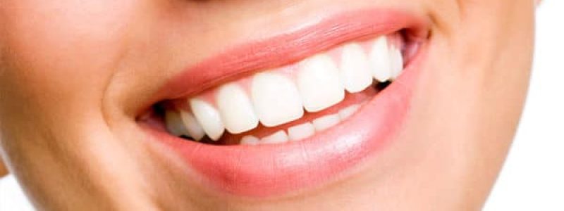 estetica-dental-carillas-dentales-1.jpg