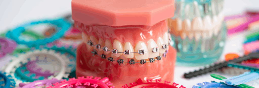 ortodoncia-brackets-lp-1